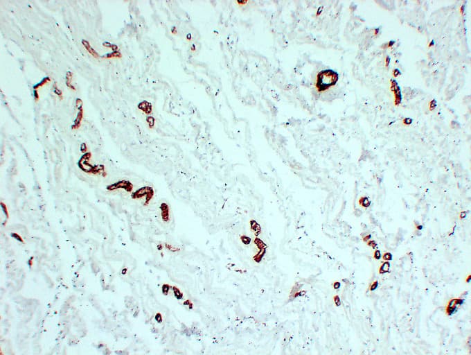 Smooth Muscle Actin Antibody (clone ABT-SMA)