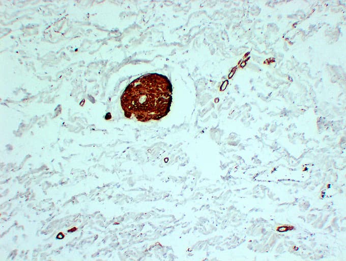 Smooth Muscle Actin Antibody (clone ABT-SMA)