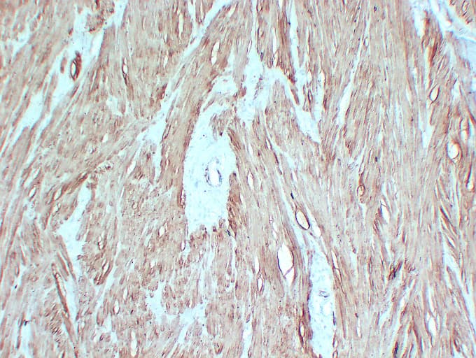 Smooth Muscle Actin Antibody (clone ABT-SMA)
