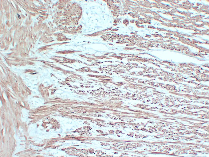 Smooth Muscle Actin Antibody (clone ABT-SMA)