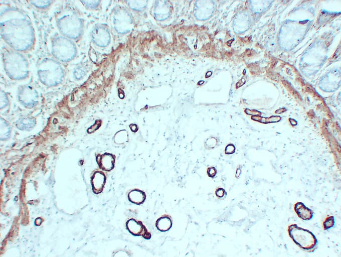 Smooth Muscle Actin Antibody (clone ABT-SMA)