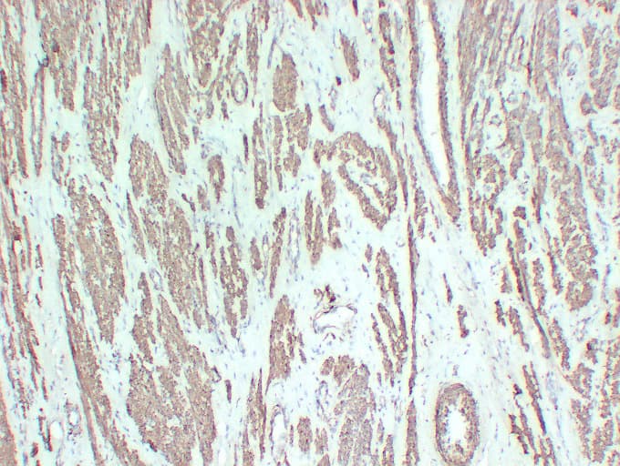 Smooth Muscle Actin Antibody (clone ABT-SMA)