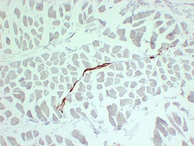 Smooth Muscle Actin Antibody (clone ABT-SMA)