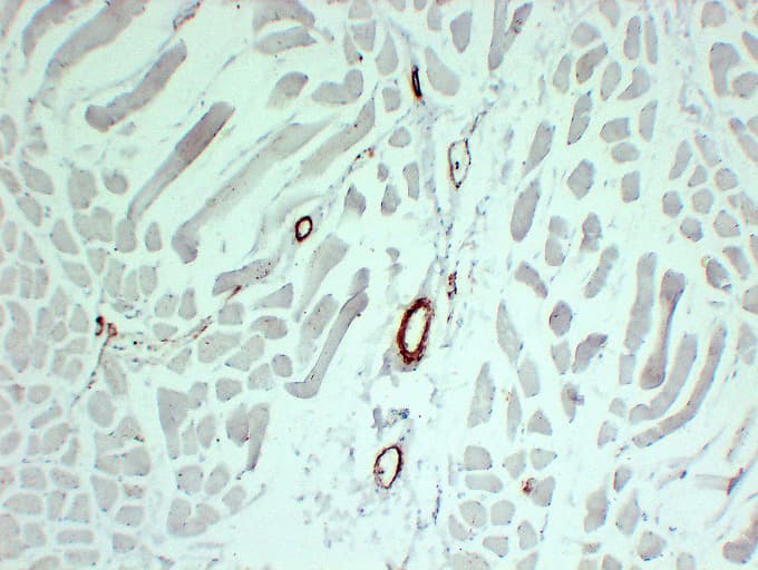 Smooth Muscle Actin Antibody (clone ABT-SMA)