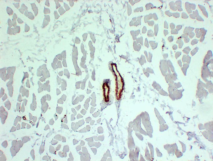 Smooth Muscle Actin Antibody (clone ABT-SMA)