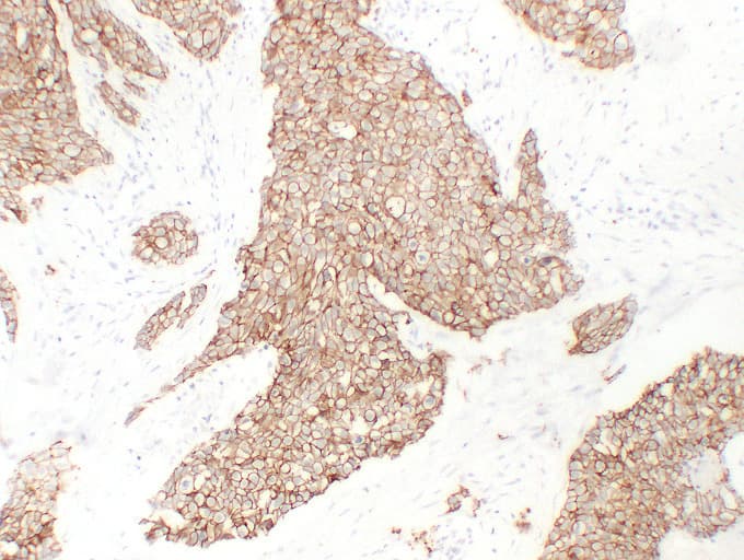 Cadherin Antibody (clone ABT-MCDH)