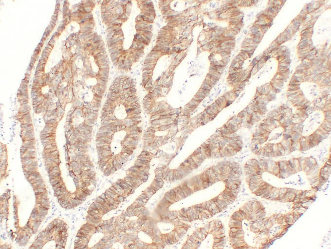 Cadherin Antibody (clone ABT-MCDH)