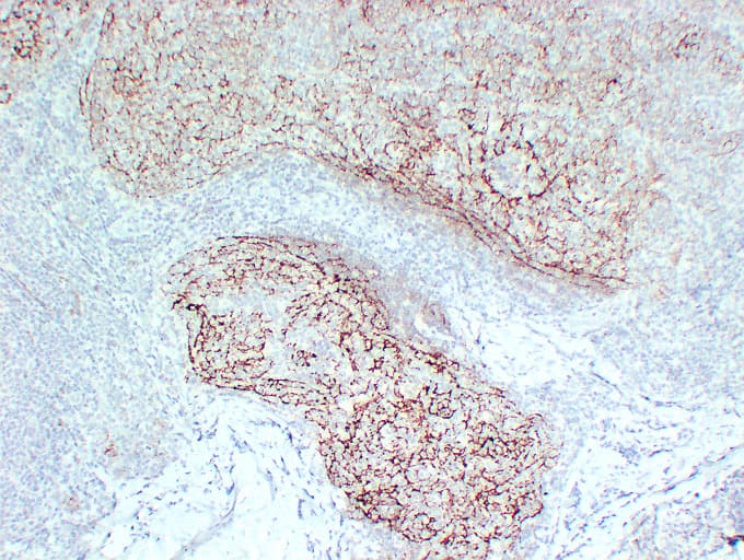 CR2 / CD21 Antibody (clone ABT-CD21)