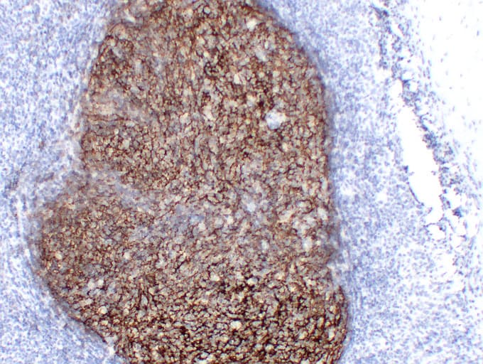 CR2 / CD21 Antibody (clone ABT-CD21)