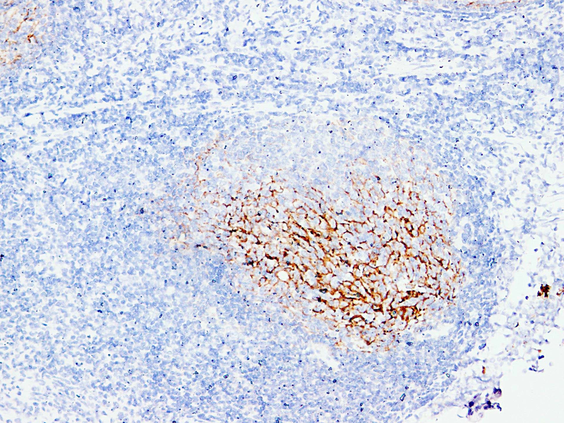 CR2 / CD21 Antibody (clone ABT-CD21)
