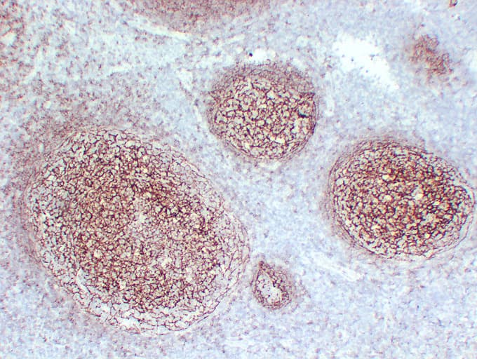 CR2 / CD21 Antibody (clone ABT-CD21)