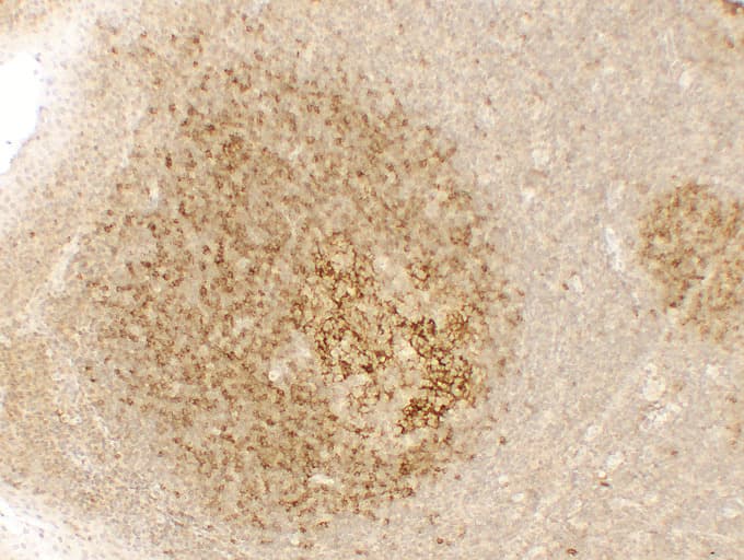 Monoclonal Mouse anti-Human FCER2 / CD23 Antibody (clone ABT-CD23, IHC)