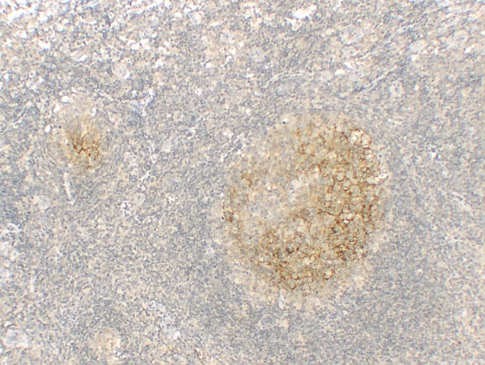 Monoclonal Mouse anti-Human FCER2 / CD23 Antibody (clone ABT-CD23, IHC)