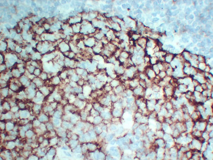 Monoclonal Mouse anti-Human FCER2 / CD23 Antibody (clone ABT-CD23, IHC)