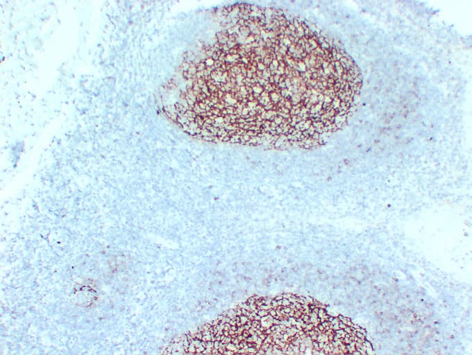 Monoclonal Mouse anti-Human FCER2 / CD23 Antibody (clone ABT-CD23, IHC)