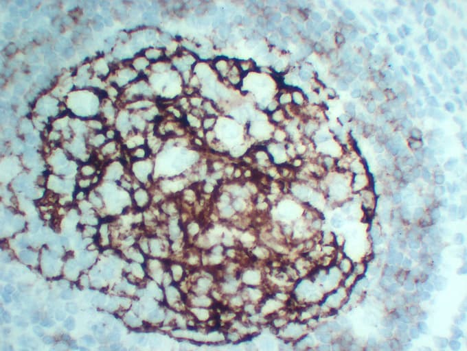 Monoclonal Mouse anti-Human FCER2 / CD23 Antibody (clone ABT-CD23, IHC)