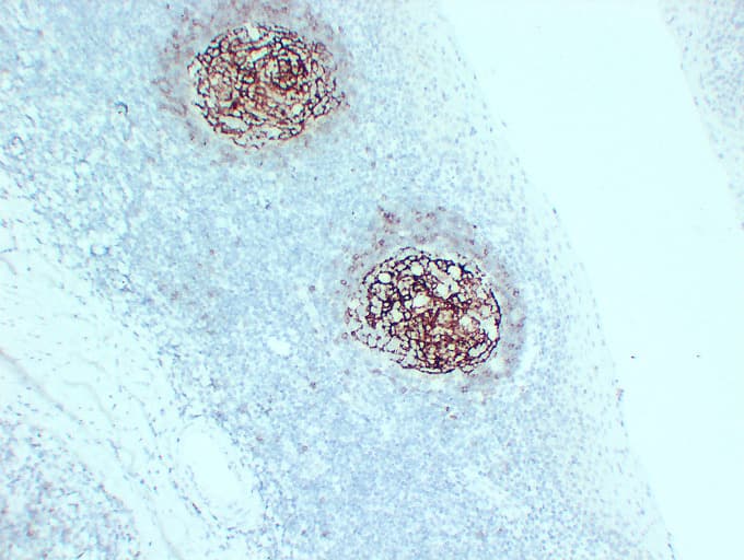 Monoclonal Mouse anti-Human FCER2 / CD23 Antibody (clone ABT-CD23, IHC)