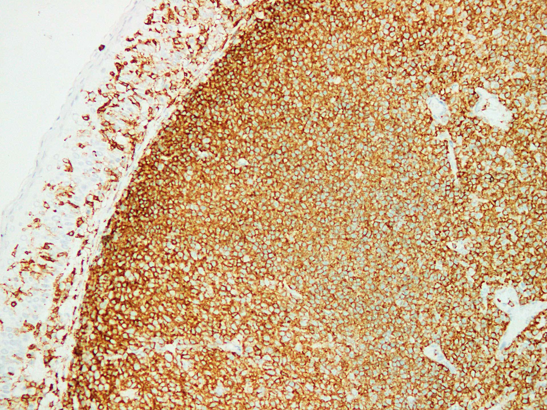 Monoclonal Mouse anti-Human CD45 / LCA Antibody (clone ABT-CD45, IHC)