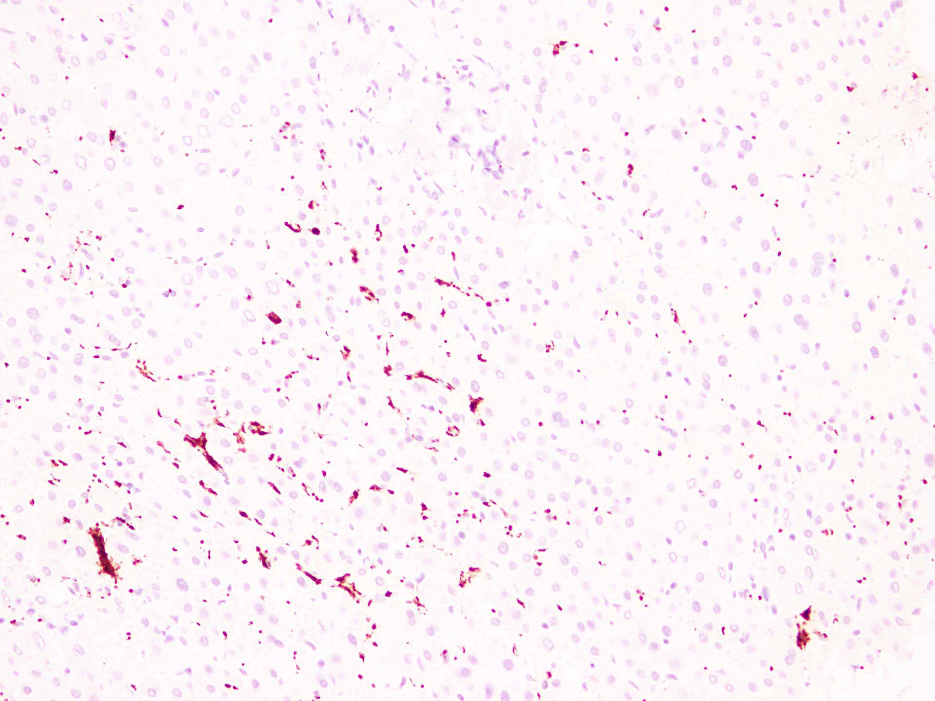 Monoclonal Mouse anti-Human ITGB3 / Integrin Beta 3 / CD61 Antibody (clone ABT-CD61, IHC)