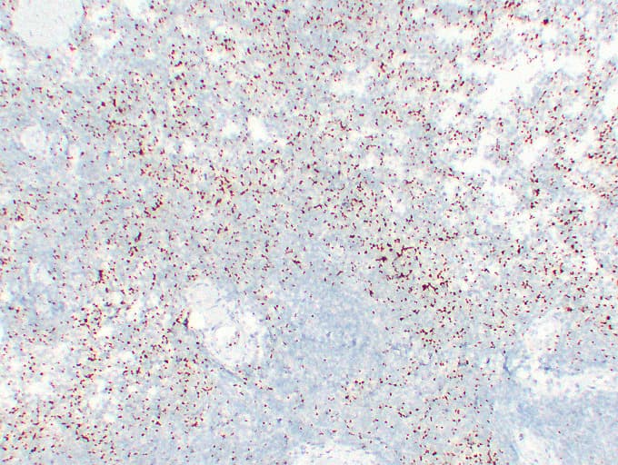 Monoclonal Mouse anti-Human ITGB3 / Integrin Beta 3 / CD61 Antibody (clone ABT-CD61, IHC)