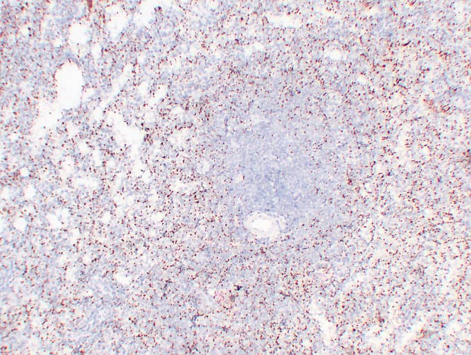 Monoclonal Mouse anti-Human ITGB3 / Integrin Beta 3 / CD61 Antibody (clone ABT-CD61, IHC)