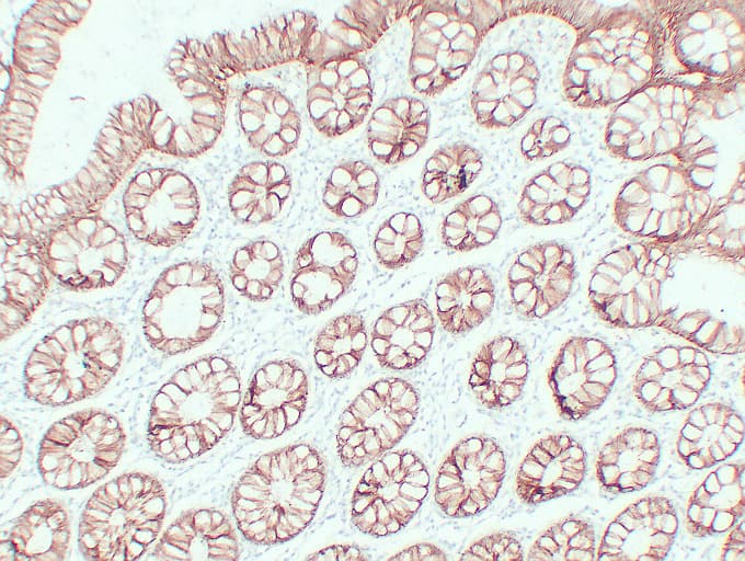 Monoclonal Mouse anti-Human CLDN4 / Claudin 4 Antibody (clone ABT-CLD4, IHC, WB)