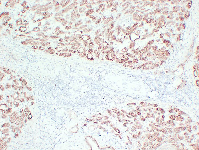 Monoclonal Mouse anti-Human CLDN4 / Claudin 4 Antibody (clone ABT-CLD4, IHC, WB)