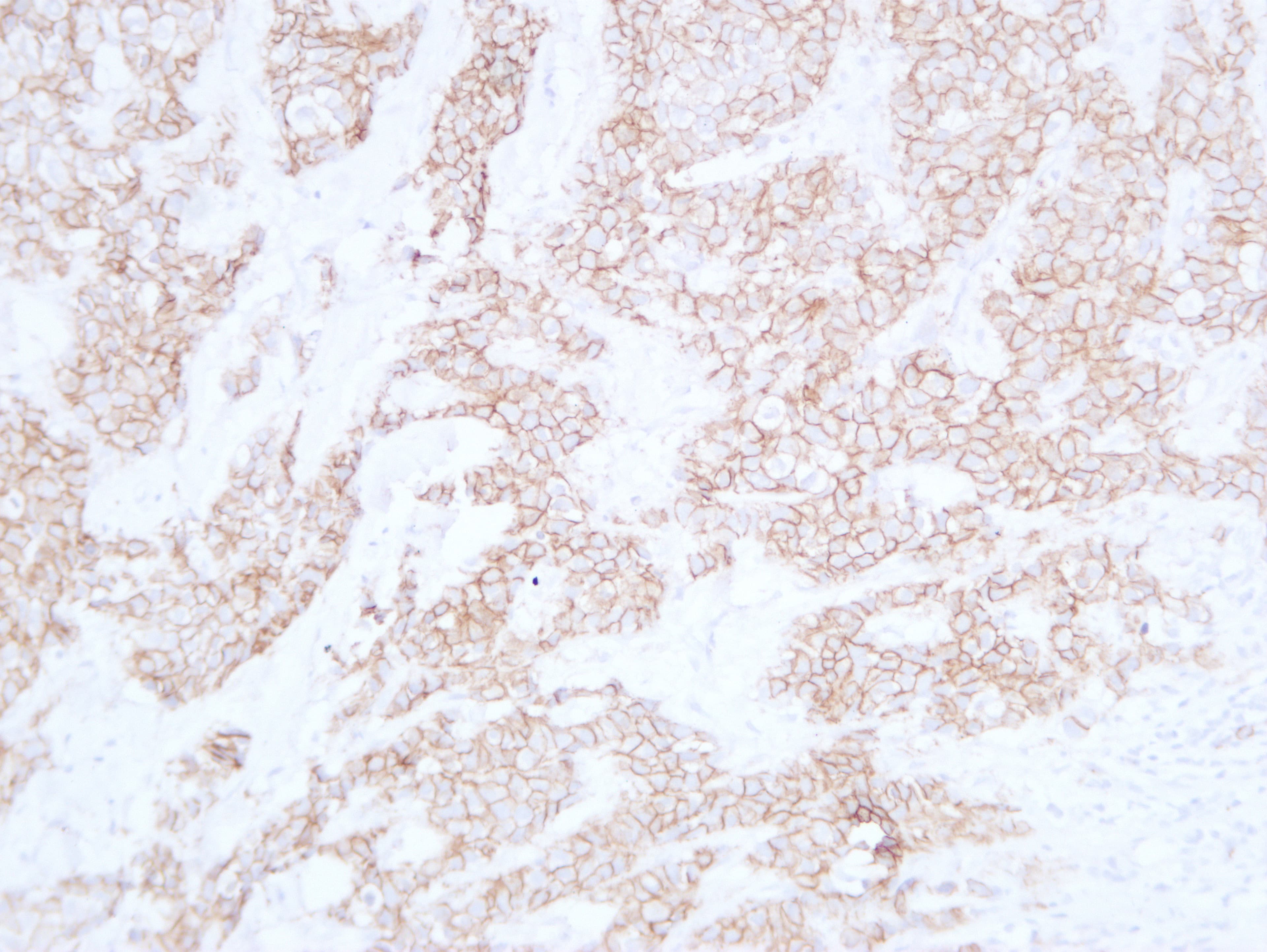 CDH1 / E Cadherin Antibody (clone ABT-CDHE)