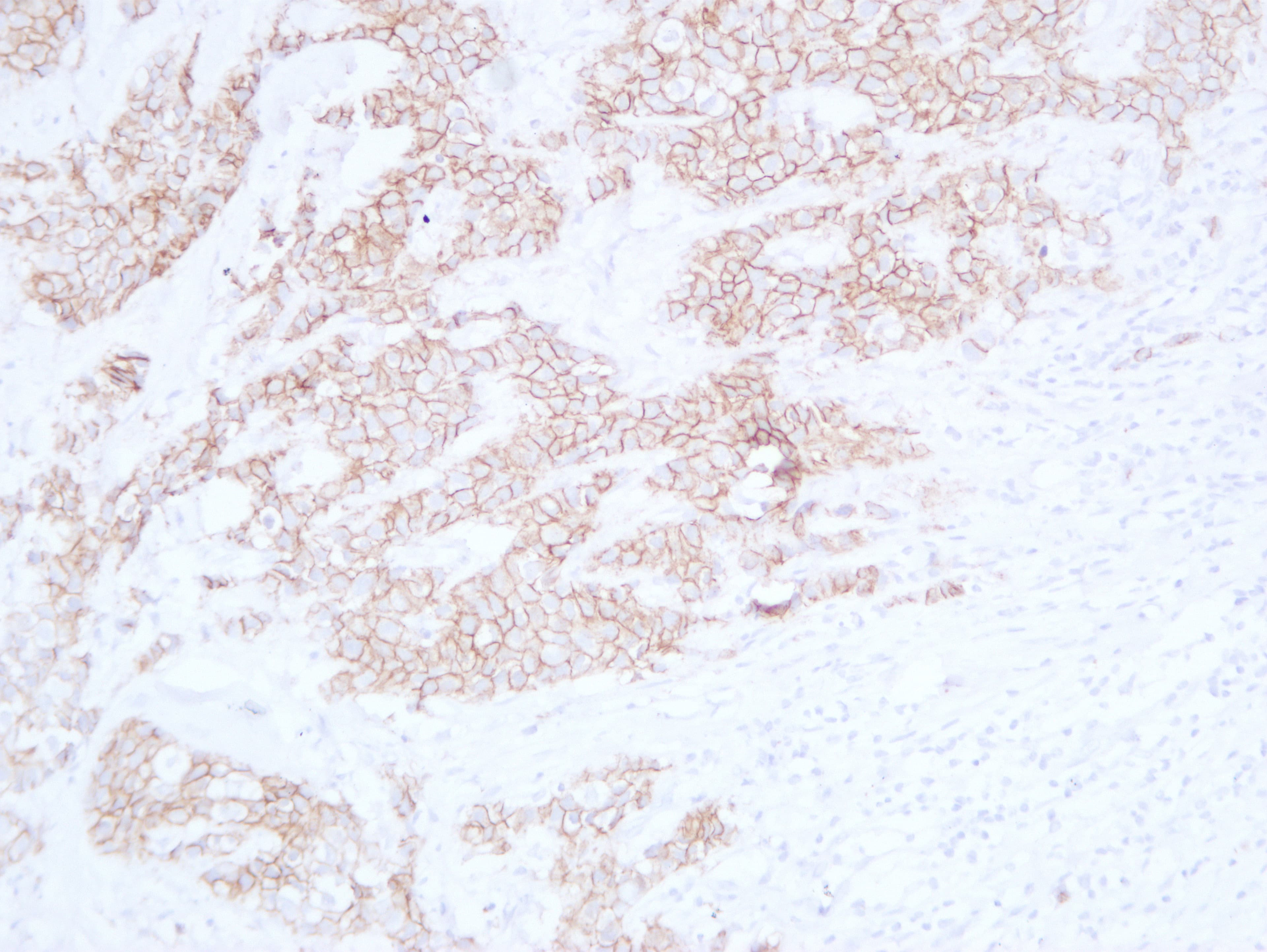 CDH1 / E Cadherin Antibody (clone ABT-CDHE)