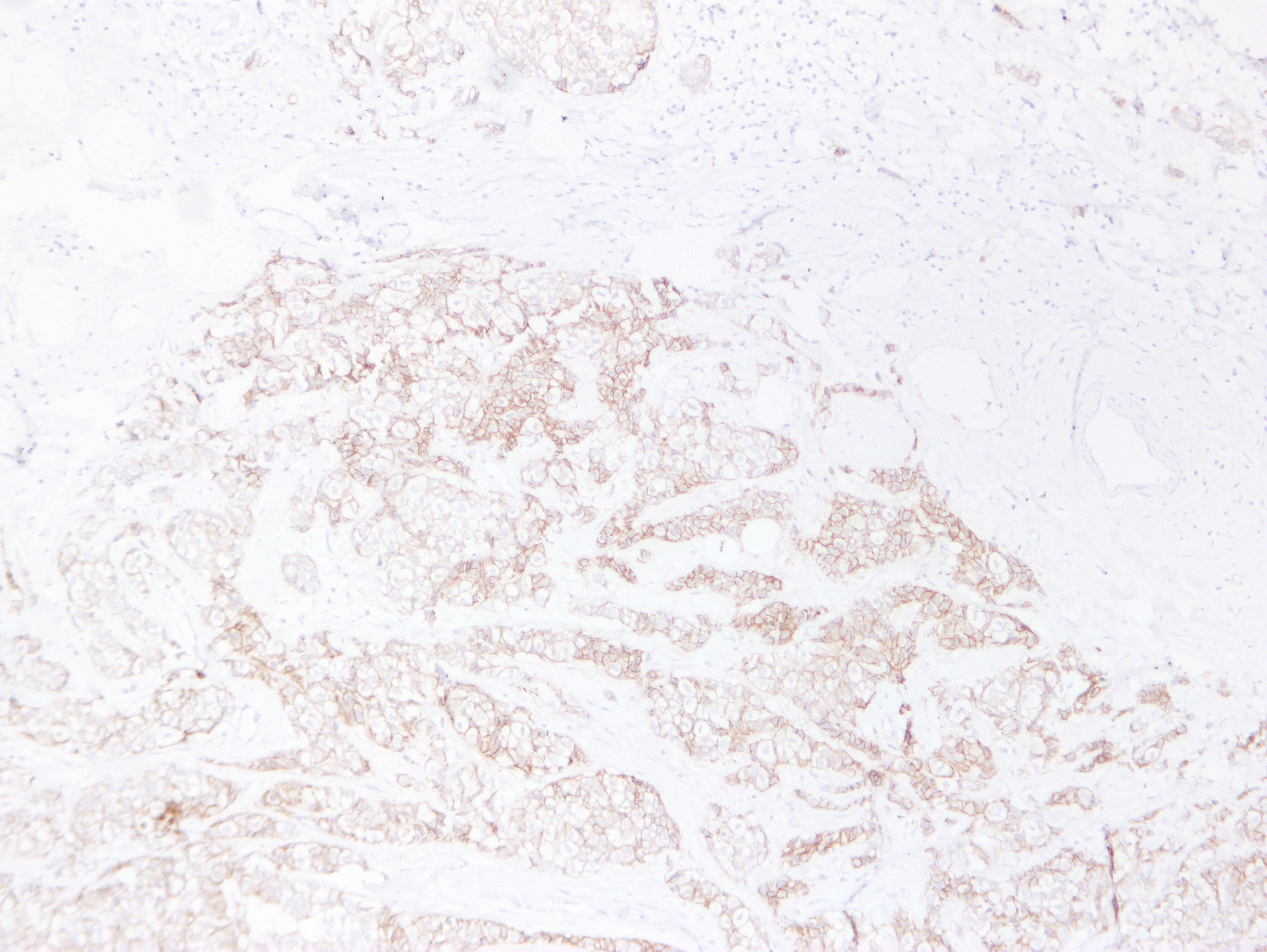 CDH1 / E Cadherin Antibody (clone ABT-CDHE)