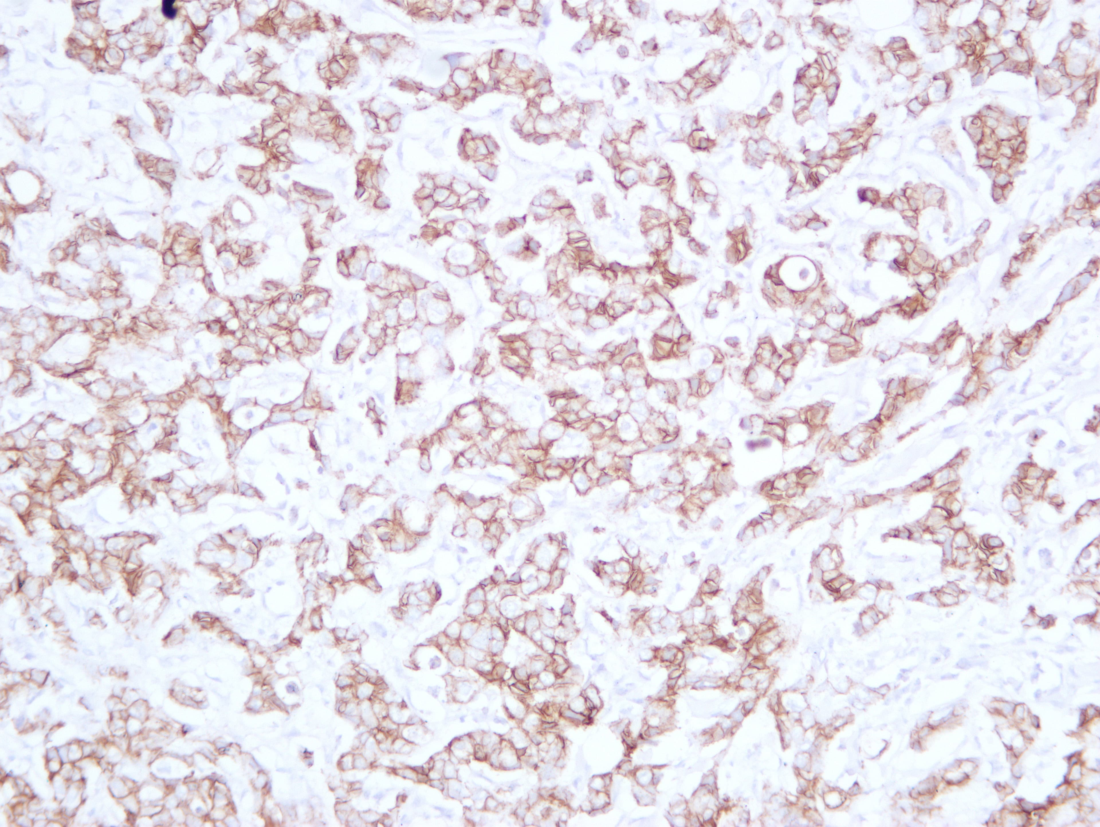 CDH1 / E Cadherin Antibody (clone ABT-CDHE)