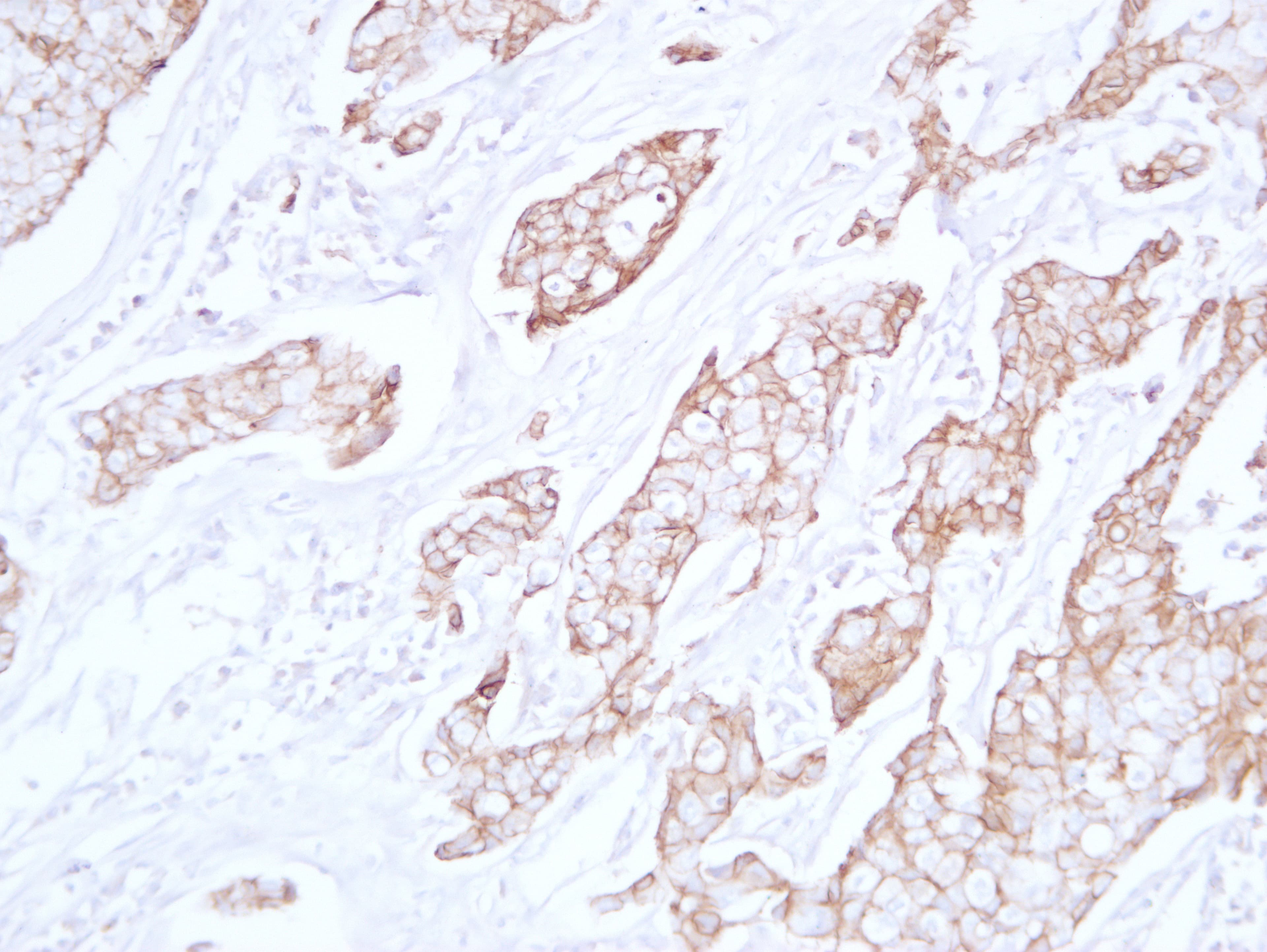 CDH1 / E Cadherin Antibody (clone ABT-CDHE)