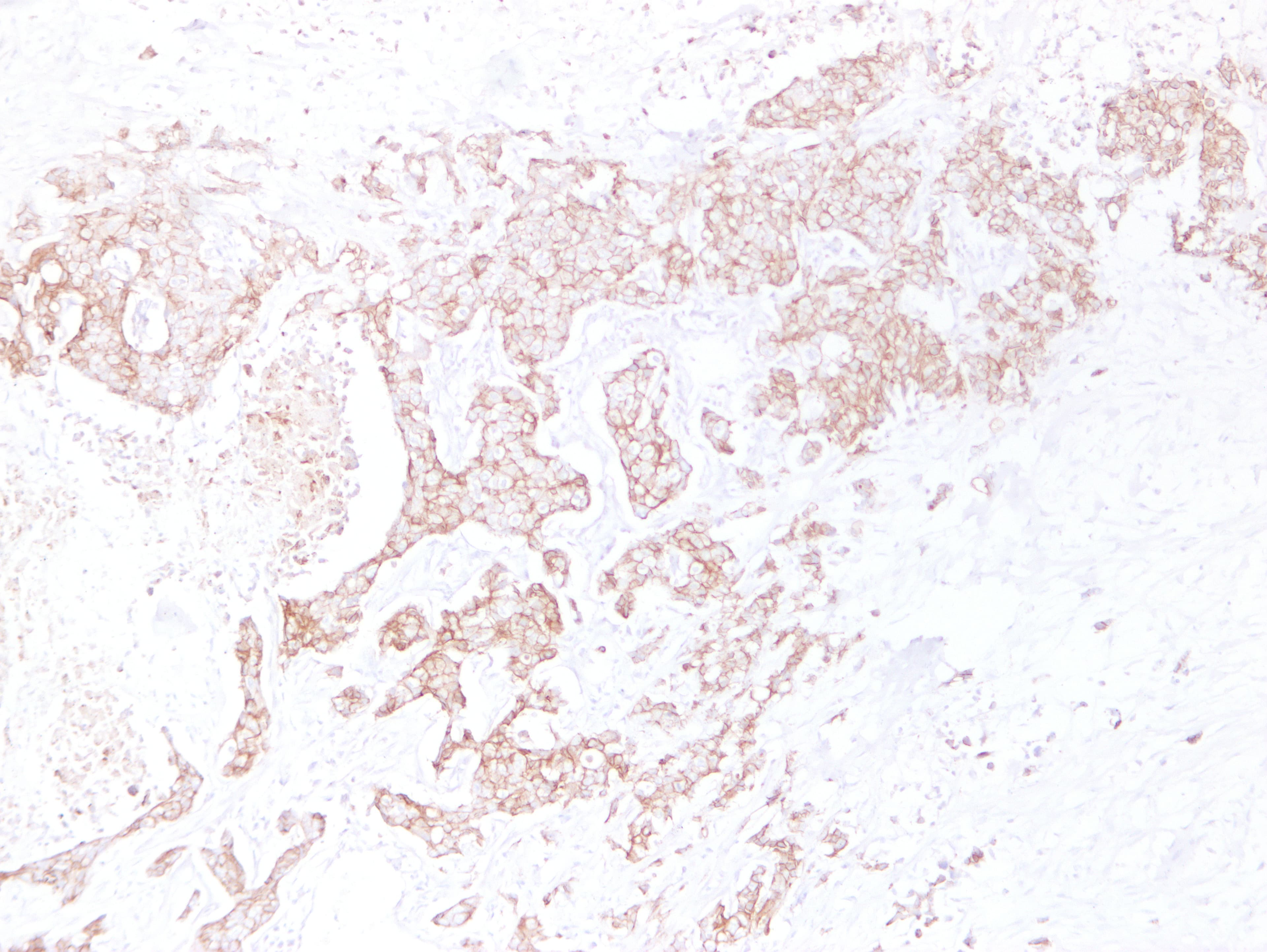 CDH1 / E Cadherin Antibody (clone ABT-CDHE)