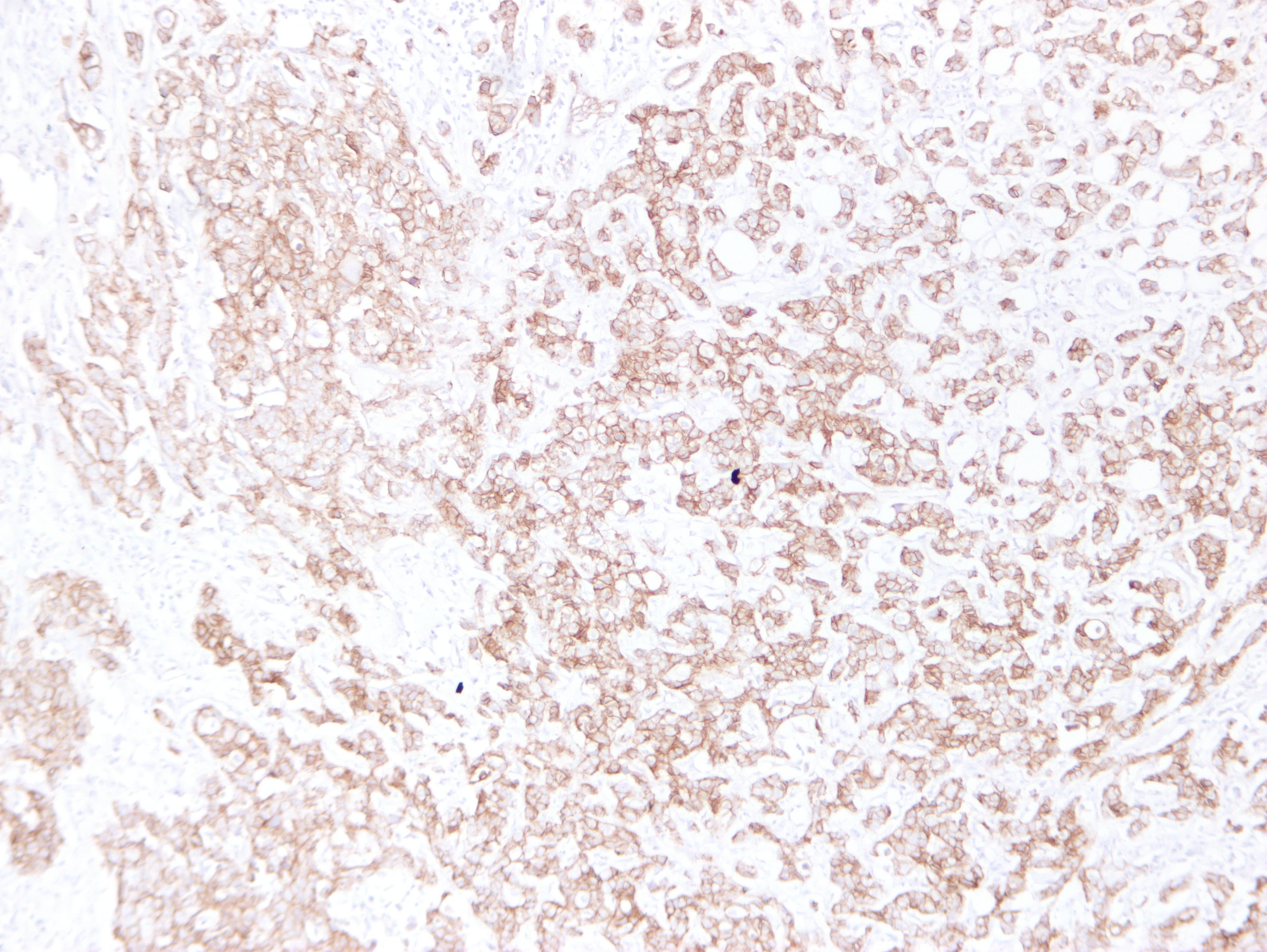 CDH1 / E Cadherin Antibody (clone ABT-CDHE)
