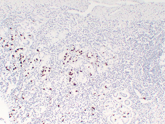 Gastrin Antibody (clone ABT-GAST)