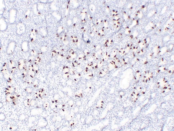 Gastrin Antibody (clone ABT-GAST)