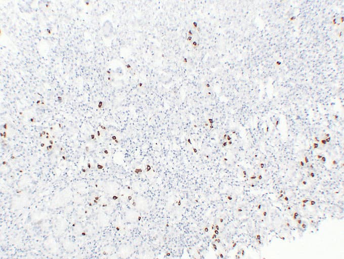 Gastrin Antibody (clone ABT-GAST)