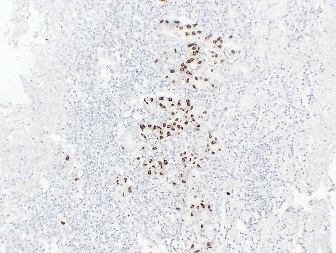 Gastrin Antibody (clone ABT-GAST)
