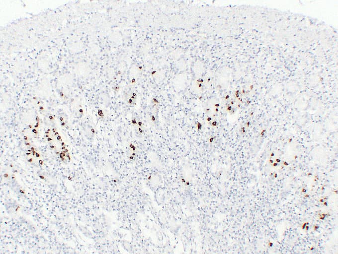 Gastrin Antibody (clone ABT-GAST)