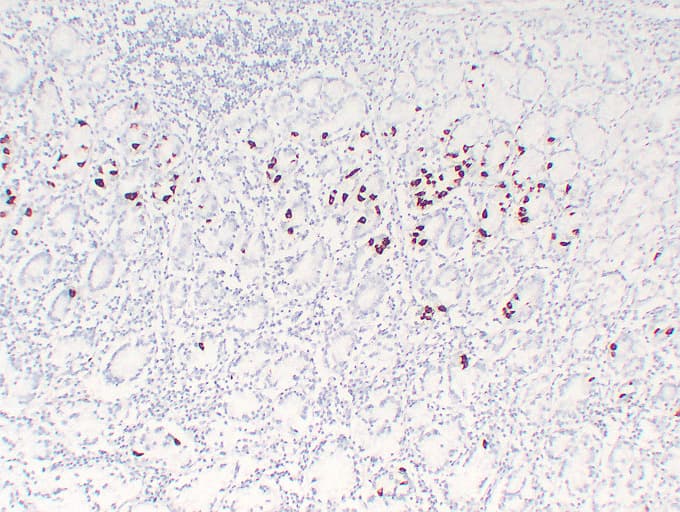 Gastrin Antibody (clone ABT-GAST)