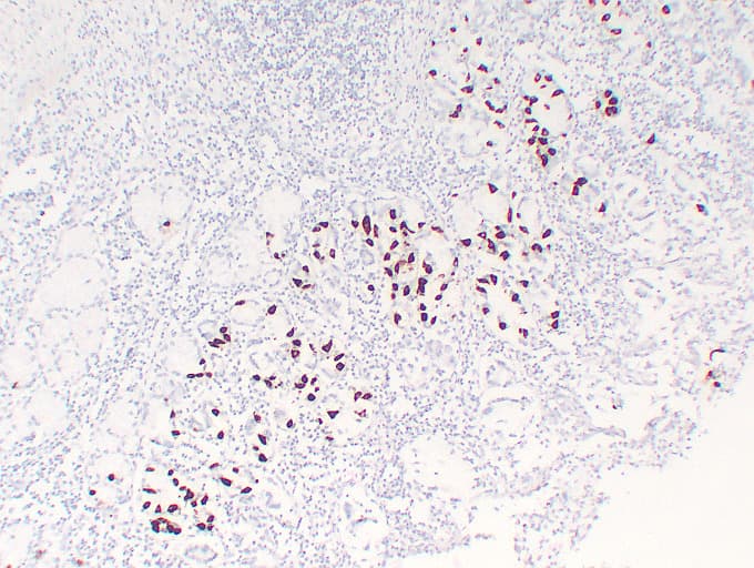 Gastrin Antibody (clone ABT-GAST)
