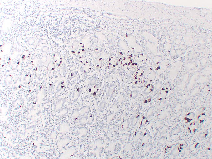 Gastrin Antibody (clone ABT-GAST)