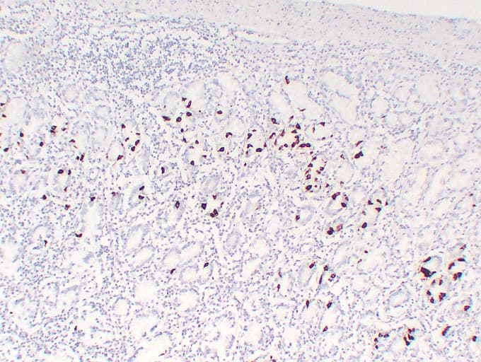 Gastrin Antibody (clone ABT-GAST)