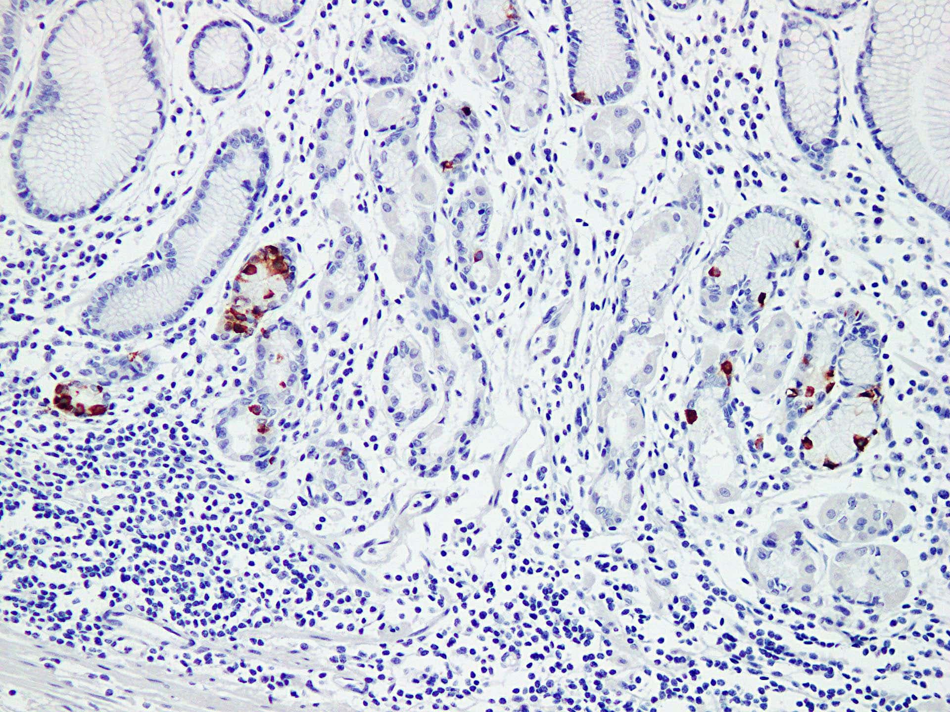 Gastrin Antibody (clone ABT-GAST)