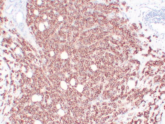 ERBB2 / HER2 Antibody (clone ABT-Her2)