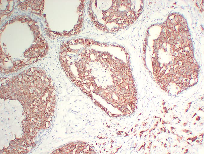 ERBB2 / HER2 Antibody (clone ABT-Her2)