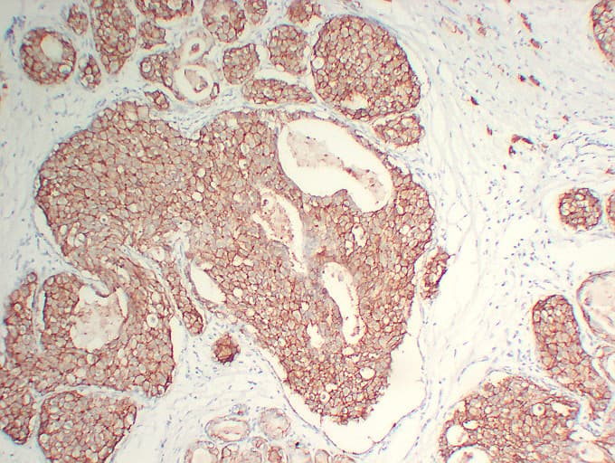 ERBB2 / HER2 Antibody (clone ABT-Her2)