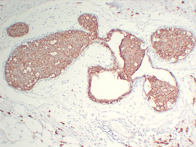 ERBB2 / HER2 Antibody (clone ABT-Her2)