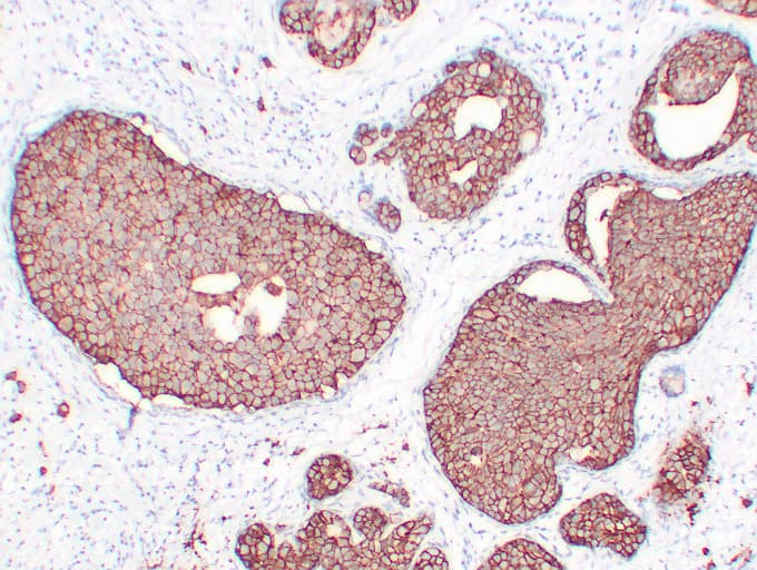 ERBB2 / HER2 Antibody (clone ABT-Her2)