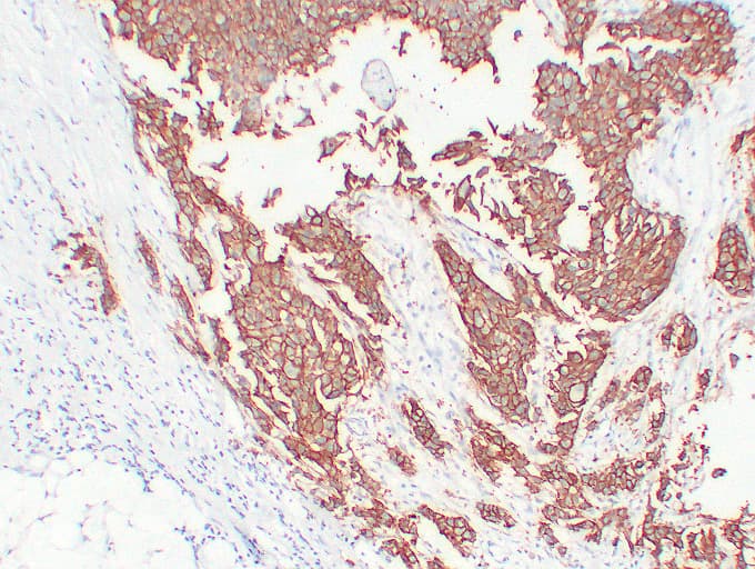 ERBB2 / HER2 Antibody (clone ABT-Her2)